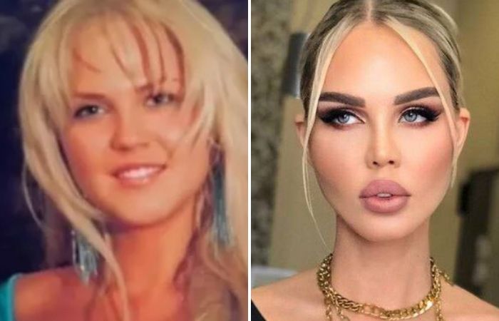 «Вернули девичью грудь!»: Писала иконы, но увлеклась «пластикой» и не может остановиться - Как новый ижидж изменил судьбу Марии Погребняк