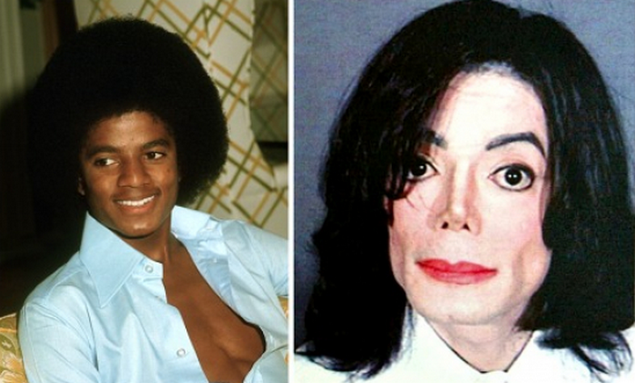 Майкл Джексон до и после операции.