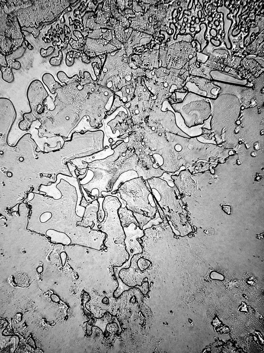 Слезы под микроскопом: фотопроект от Розы-Линн Фишер (Rose-Lynn Fisher)