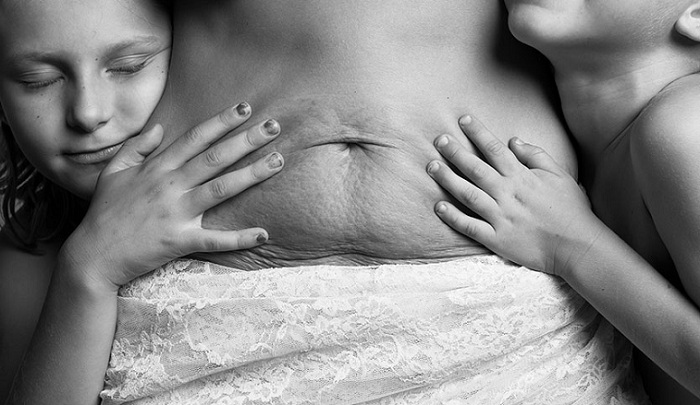 Beautiful Body Project - снимки матерей с неидеальными телами.