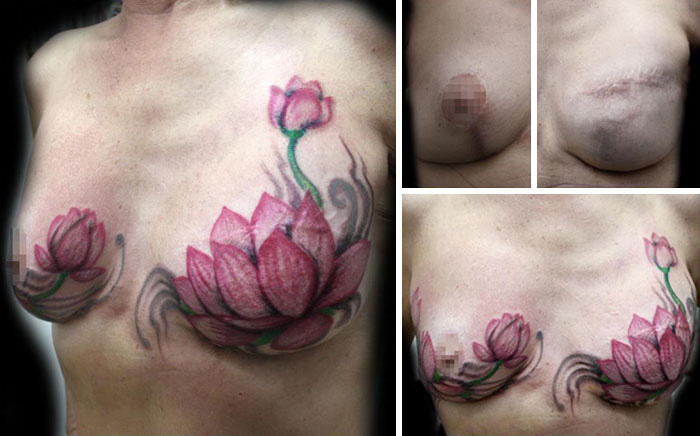 Татуировки, маскирующие последствия мастэктомии.