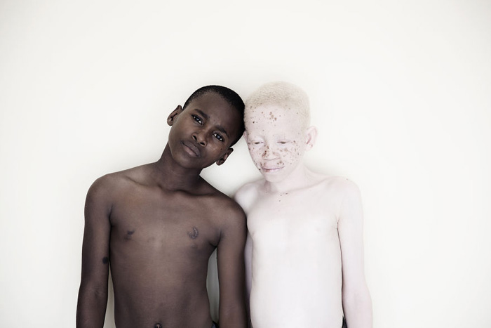За голову ребенка-альбиноса в Танзании назначена награда. Фото: Marinka Masseus.