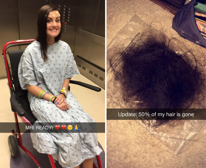 У Элли диагностирован рак мозга. После рецидива ей пришлось пройти химиотерапию, и  волосы девушки стали выпадать.