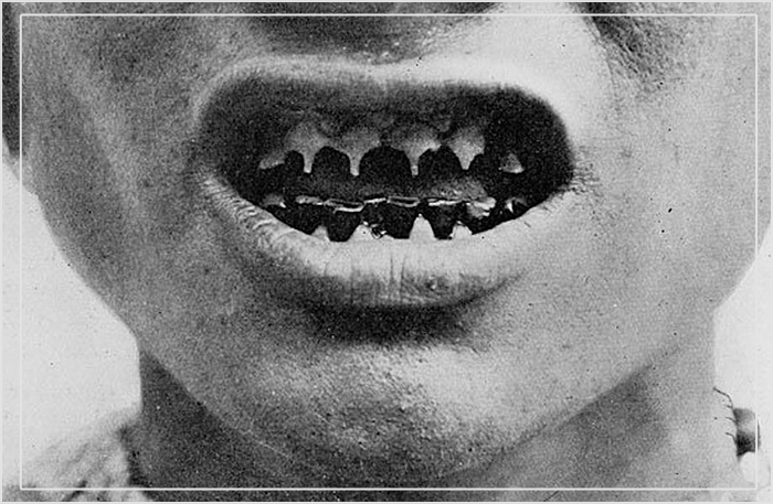 Острые зубы - это не только красота, но и весьма грозное оружие в ближнем бою.