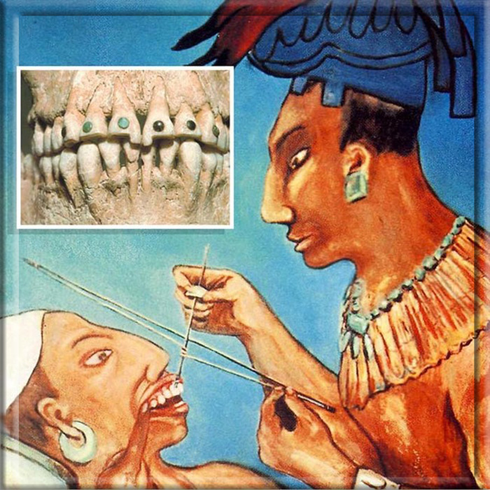 Стоматология у майя была на высшем уровне.