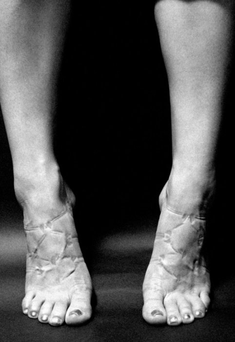 Так выглядят ноги женщины, после обуви с лямками и на высоком каблуке. Автор фото: Джастин Бартелс (Justin Bartels).