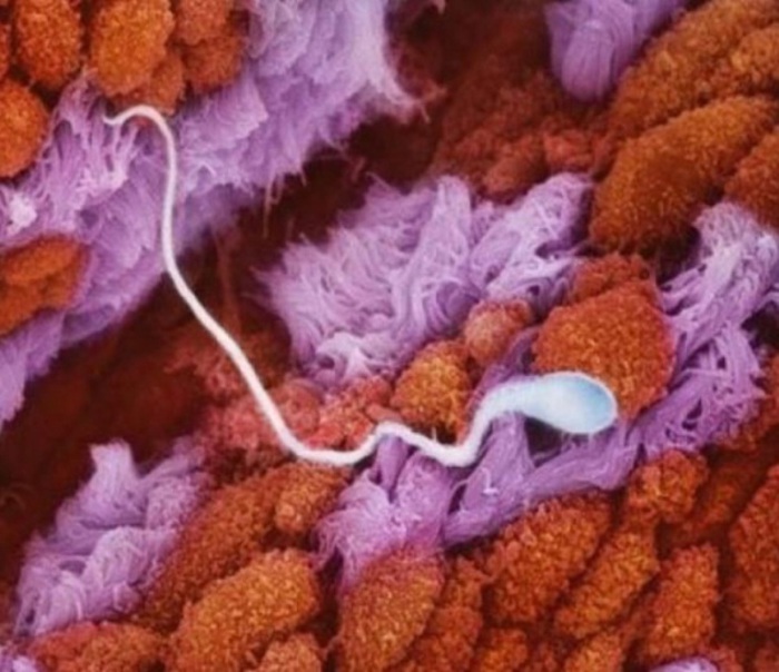 Сперматозоид в маточной трубе движется навстречу яйцеклетке. Автор фото: Леннарт Нильсон (Lennart Nilsson).