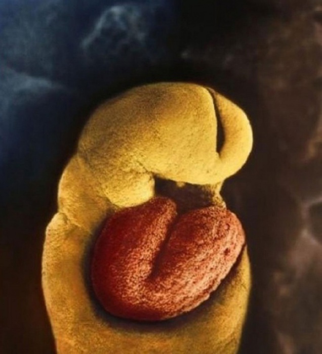 На 18-й день у зародыша начинает пульсировать сердце. Автор фото: Леннарт Нильсон (Lennart Nilsson).