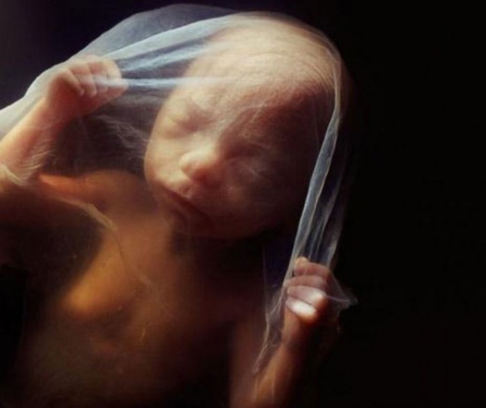 18 недель. Зародыш может воспринимать звуки из внешнего мира. Автор фото: Леннарт Нильсон (Lennart Nilsson). 