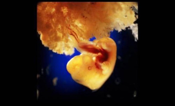 40 дней. Наружные клетки зародыша срослись с рыхлой поверхностью матки и образуют плаценту. Автор фото: Леннарт Нильсон (Lennart Nilsson).