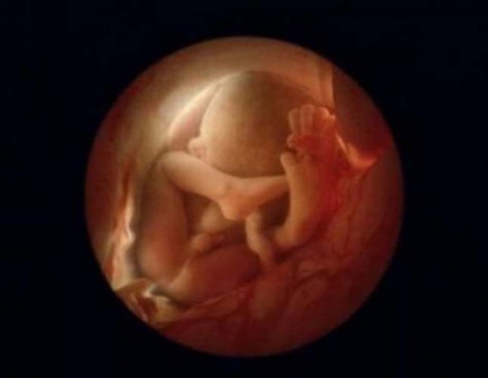 36 недель. Через месяц малыш появится на свет. Автор фото: Леннарт Нильсон (Lennart Nilsson).