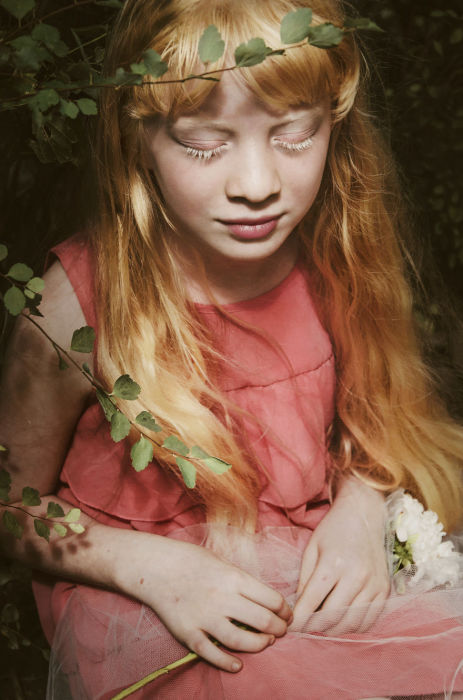 Девочка-альбинос. Автор фото: Мишель де Роса (Michelle de Rose).