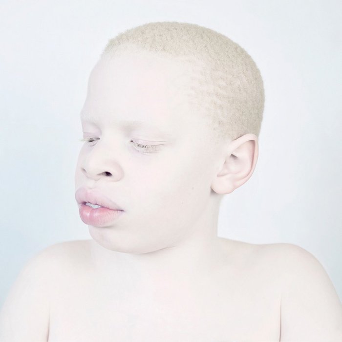 Африканский альбинос. Фото Sanne De Wilde.