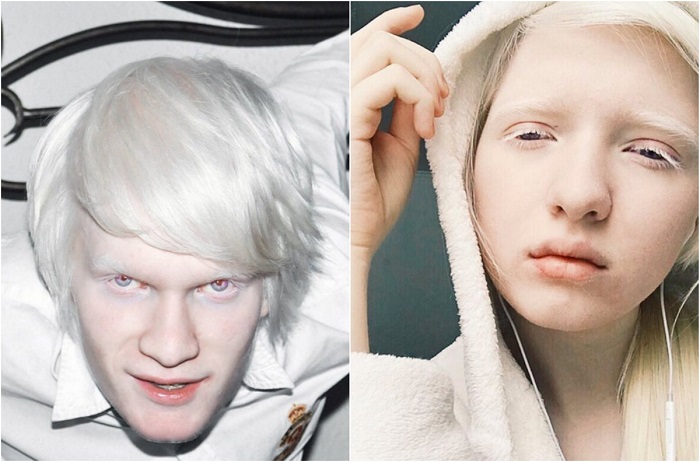 Белые волосы, белая кожа. Как живёт модель-альбинос из Актобе