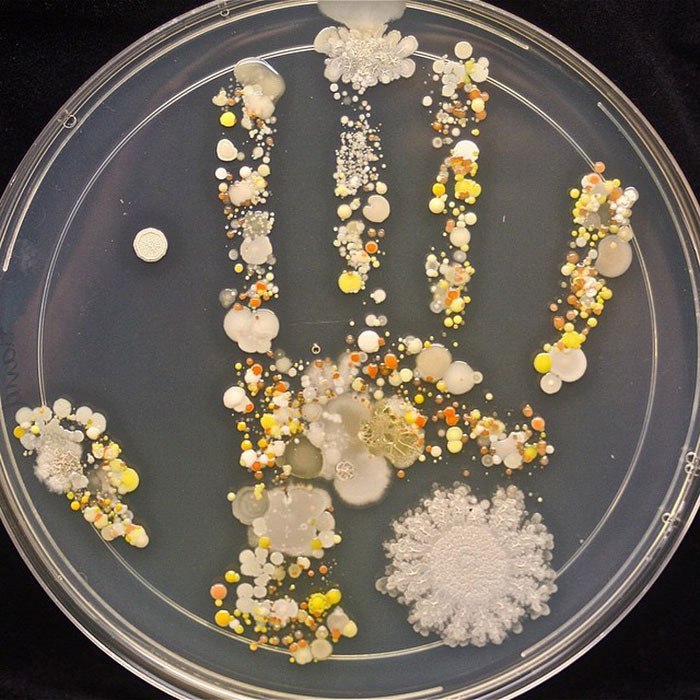 На отпечатке 8-летнего сына Таши разрослись разные колонии бактерий. Автор Таши Штурм.