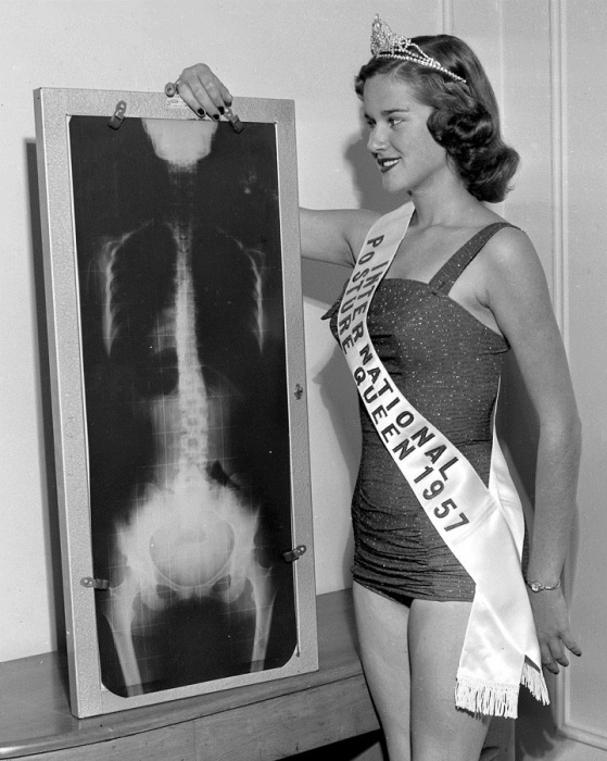Диана Стопки из Сент-Луис в 1957 году стала победительницей международного конкурса «Королева осанки».