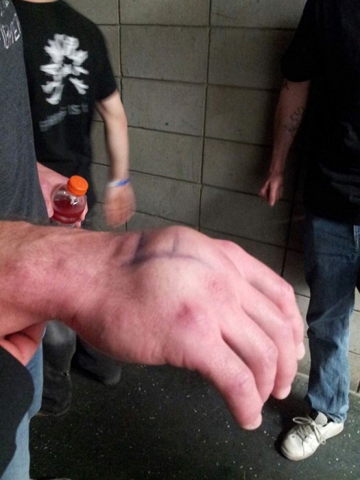 Рука боксера после того, как он нанес нокаутирующий удар.