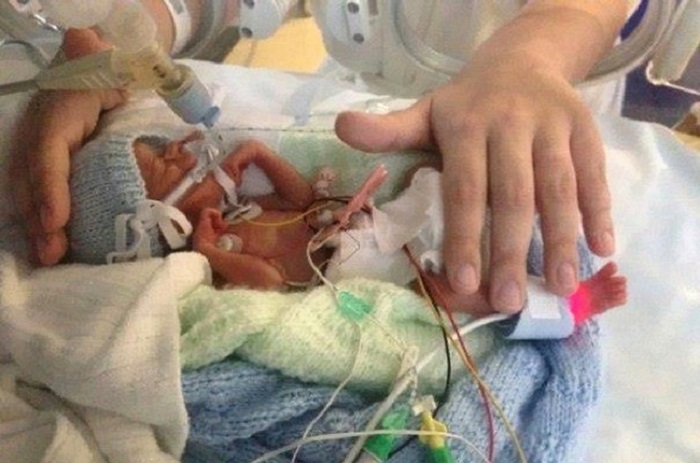 Итан Берд одержал победу в схватке за жизнь после того, как родился на 26 неделе беременности и весил всего около 500 грамм.
