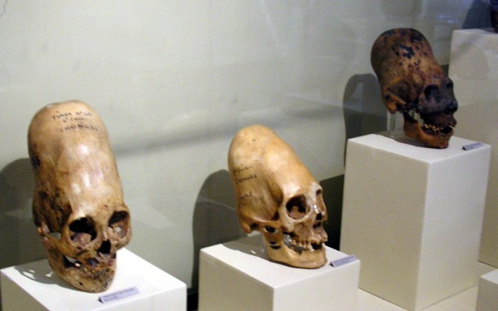 Черепа культуры Паракас на выставке в музее города Ика в Перу. | Фото: commons.wikimedia.org.