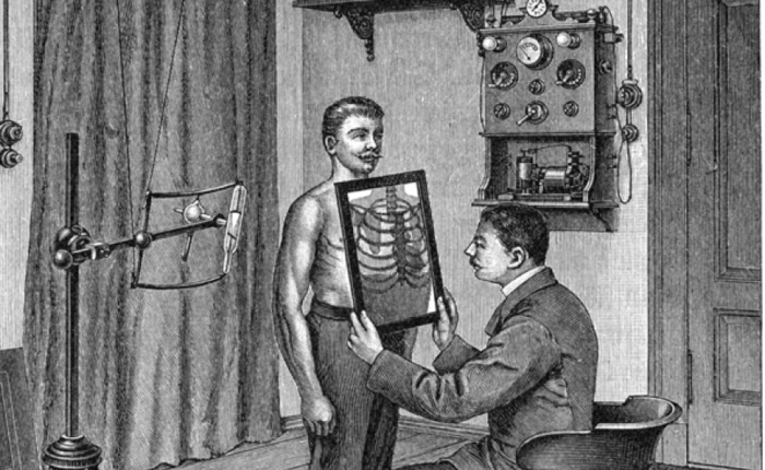 Врач смотрит рентгенограмму грудной клетки пациента, начало ХХ века. | Фото: nlo-mir.ru.