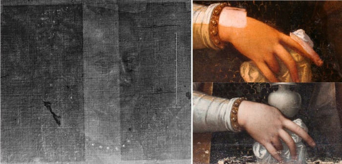 Рентгеновский снимок (слева). Уменьшенная рука и исчезнувшая после «фотошопа» деталь (справа).