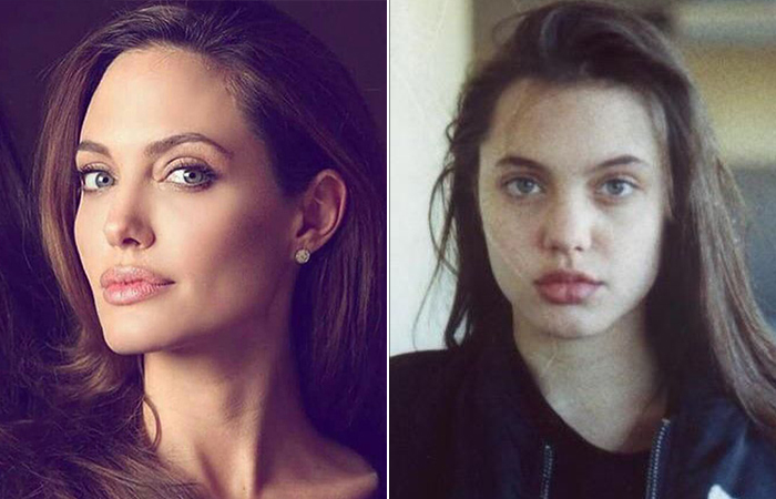 Анджелина Джоли - до и после пластики.