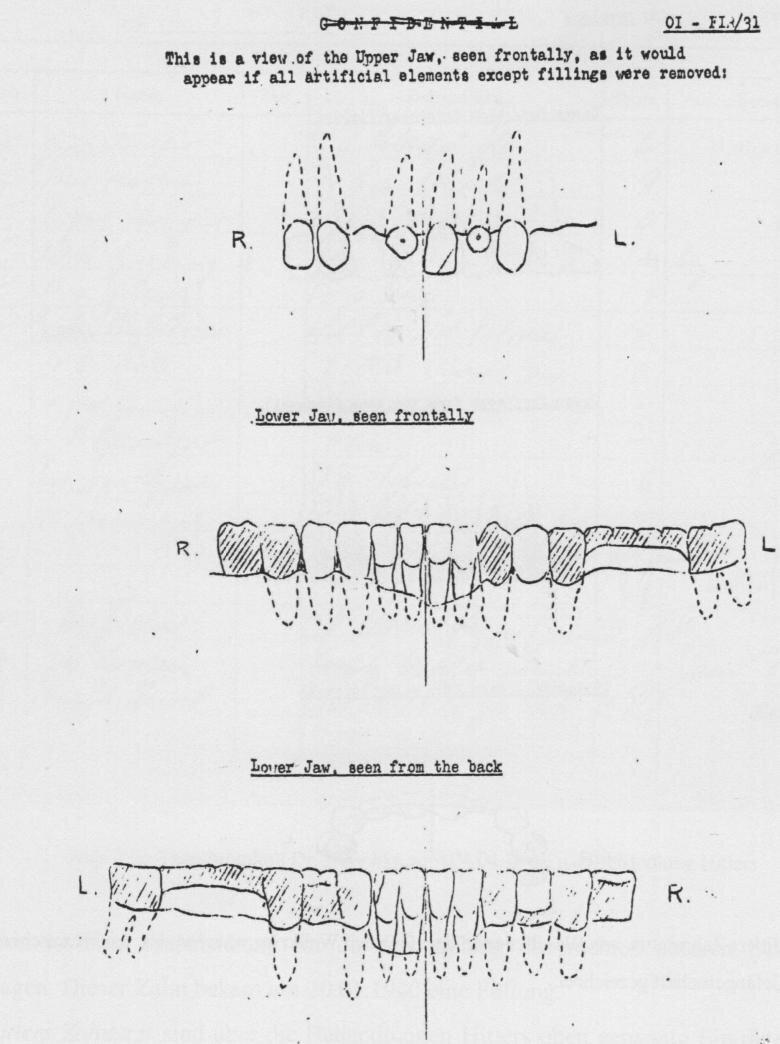 Схема строения зубов Гитлера.