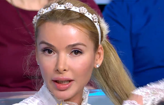 Алёна Кравец без парика. 