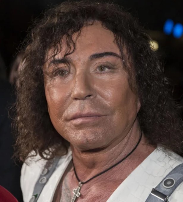 Валерий Леонтьев начал делать пластику еще в 80-х. Валерий Леонтьев начал делать пластику еще в 80-х.