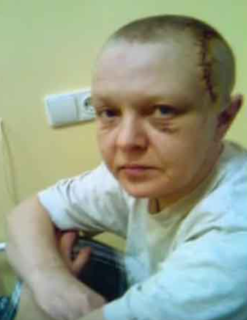 Маргарита Сергеечева перенесла операцию на мозге. / Фото: stuki-druki.com