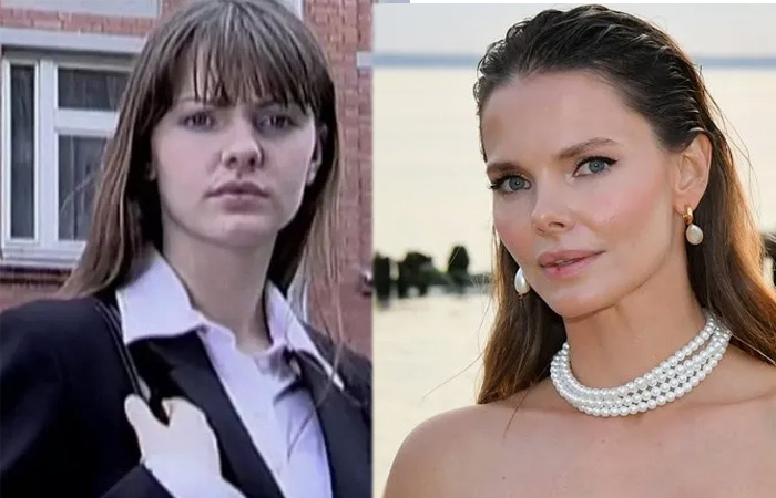 Елизавета Боярская делала несколько пластических операций. Елизавета Боярская делала несколько пластических операций.