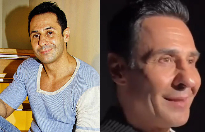 Стас Костюшкин делает уколы ботокса.