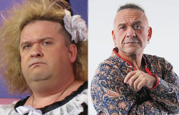 «Сделал пластику даже там»: 10 российских мужчин-артистов, которые решились на пластику и изменились до неузнаваемости