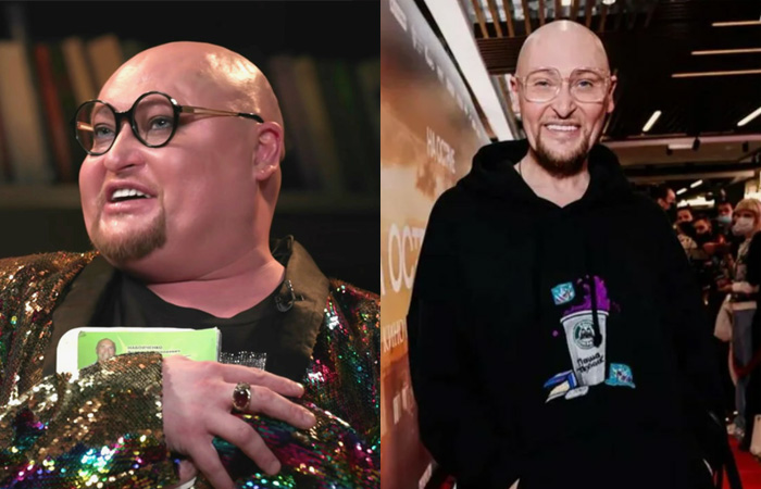 Шура делал несколько липосакций.