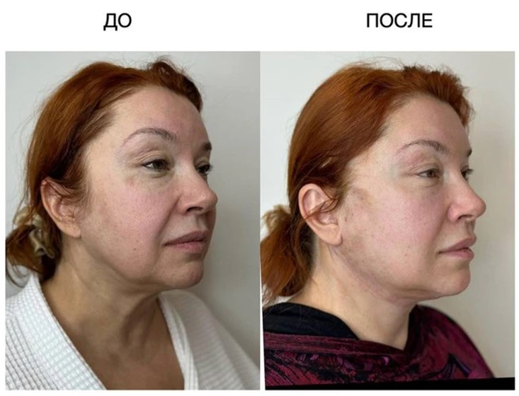 Вера Сотникова не довольна результатом косметолога и подала на клинику в суд.