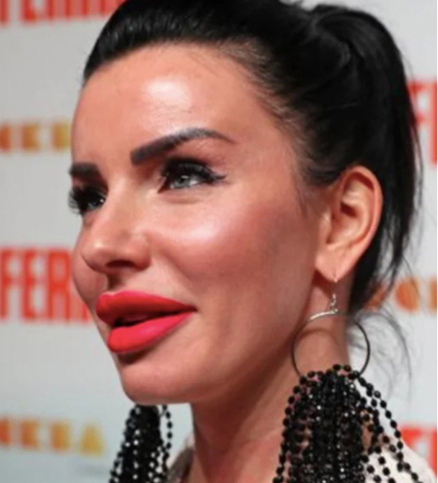 Юлия Волкова после операций. Юлия Волкова после операций.