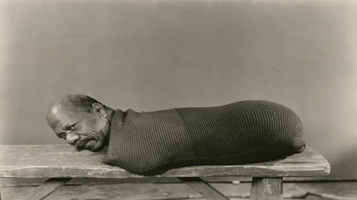 Он научился сам себя обслуживать и стал артистом цирка.