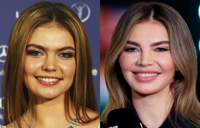 Алина Кабаева до и после пластических операций./Фото: peopletalk.ru