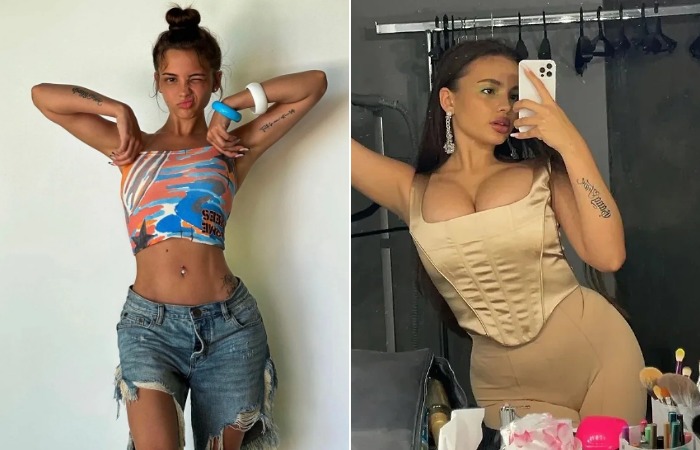 Валя Карнавал до и после пластики. Валя Карнавал до и после пластики.