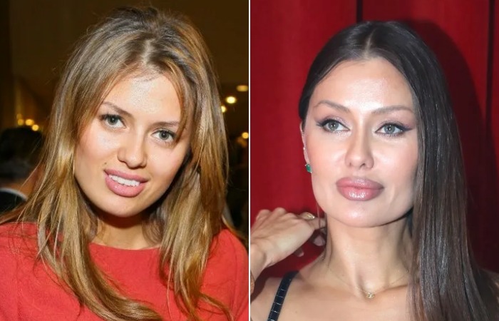 Виктория Боня до и после пластики.