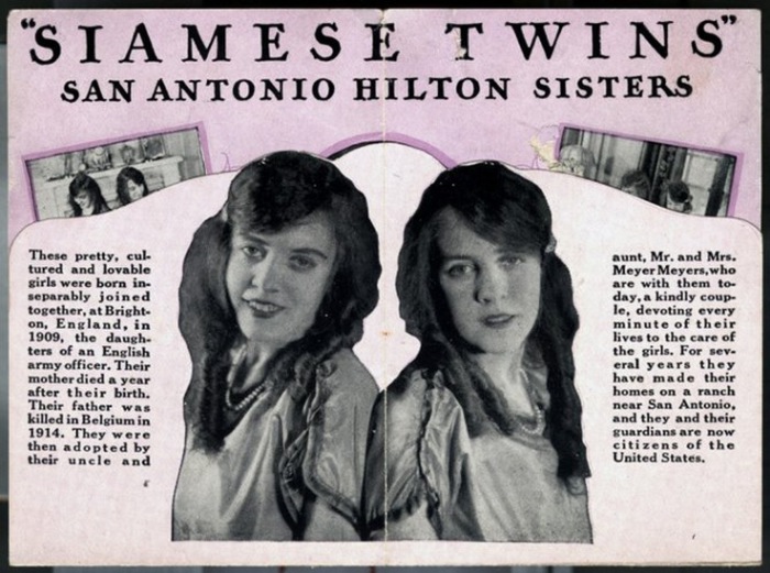 Сёстры Хилтон: грустная история актрис водевиля, которые были сиамскими близнецами Хилтон, Дэйзи, сёстры, сестёр, жизнь, Виолетт, девушки, умерла, девочек, оказалось, время, жизни, сразу, сросшихся, открыли, оказалась, маникюр, близнецы, своим, чтобы