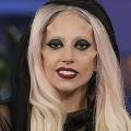 Леди Гага отказалась от лицевых имплантатов 